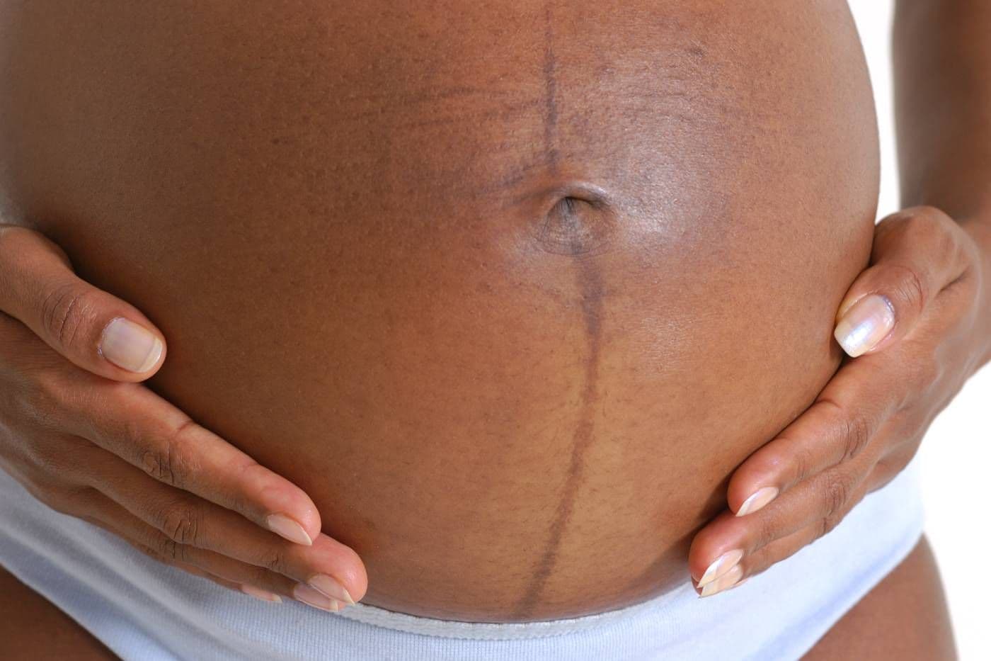 pregnant belly showing pregnancy line