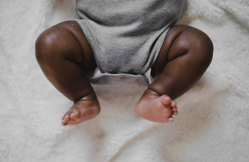 Hip Dysplasia in Babies: What Parents Need to Know